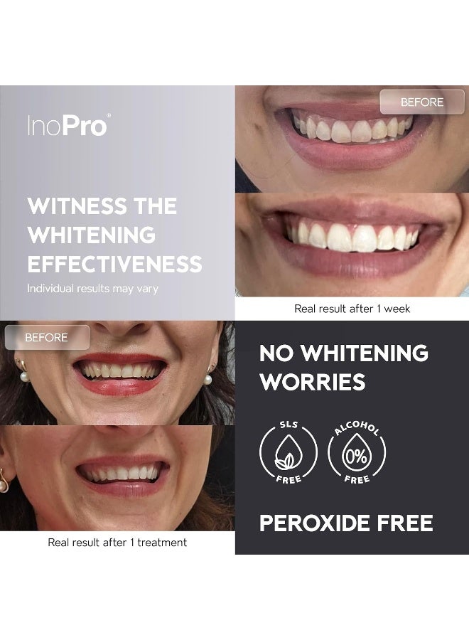 InoPro Natural Teeth Whitening Strips Kit 14 Treatments - Sensitive Teeth Whitener, Peroxide Free, Enamel Safe White Strips - Instant Teeth Whitening Without The Harm (28 Strips) - Image 2